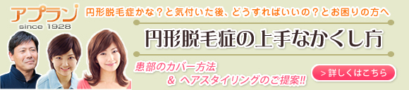 円形脱毛症の上手なかくし方